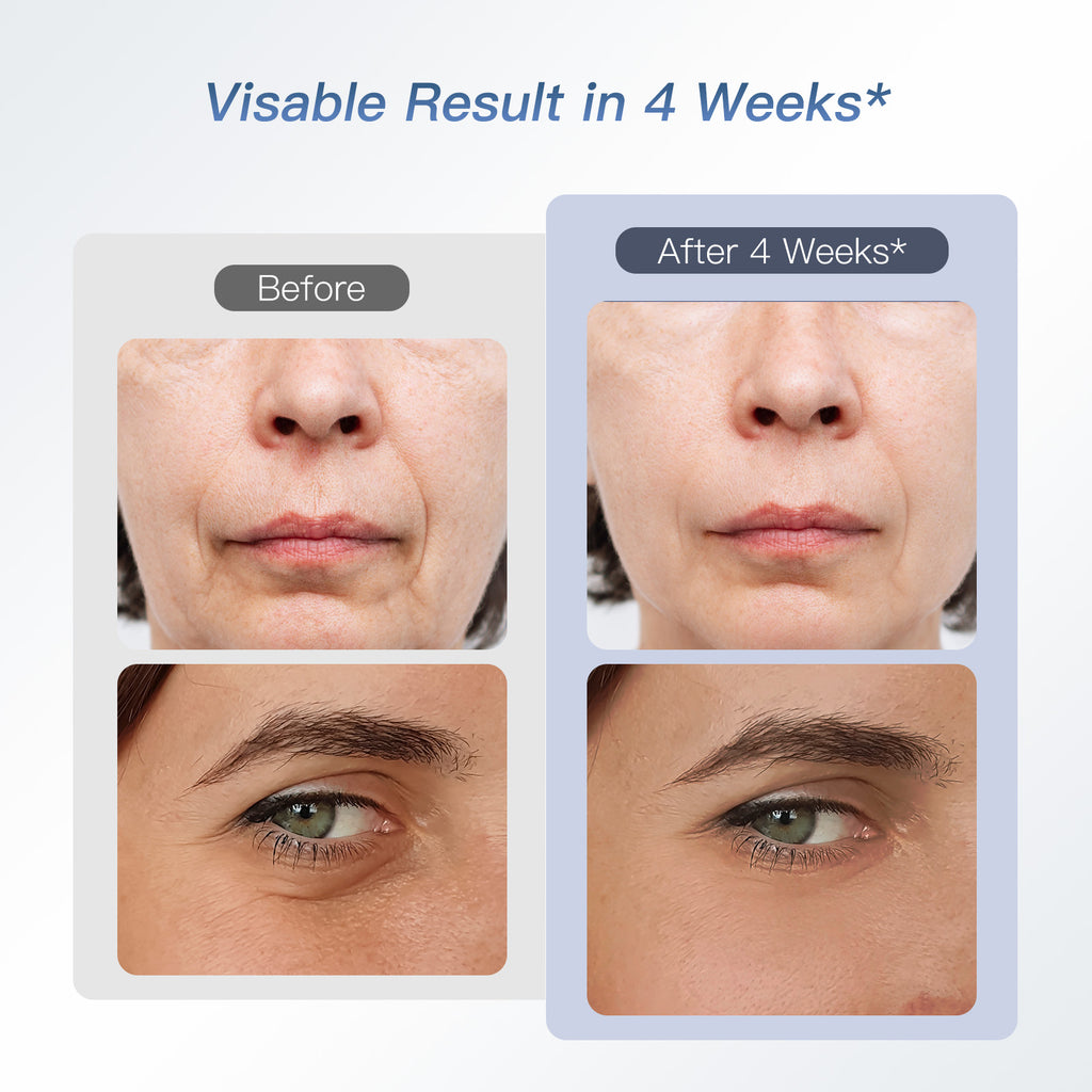 M2 Pro Collagen Firming Beauty Device | 6-in-1 RF & Microcurrent Facial Skincare Wand